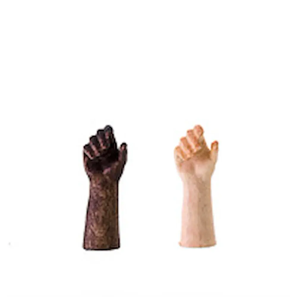 Closed hand